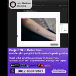 Jasa machine learning Project Skin Detection, mendeteksi penyakit kulit manusia pada gambar