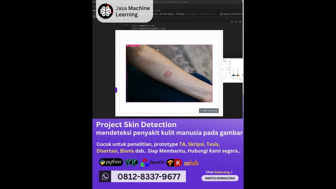 Jasa machine learning Project Skin Detection, mendeteksi penyakit kulit manusia pada gambar